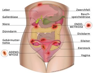 AnatomieEndo